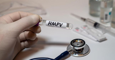 IDI Sebut Ada Potensi Mutasi HMPV, Tapi Pandemi Masih Jauh