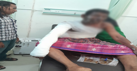 Nekat Bakar Diri, Warga Anambas Ini Alami Luka Bakar Hingga 60 Persen