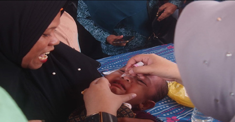 PIN Polio, Dinkes Karimun Sasar 26.788 Anak Usia 0-7 Tahun