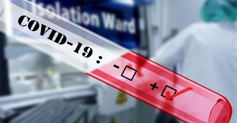 Satu Orang Warga Lingga Terkonfirmasi Positif Covid-19