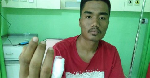Laka Kerja Kembali Terjadi di PT MOS, Jari Kelingking Pekerja Putus