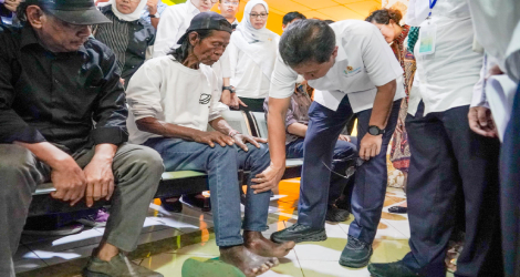Menkes Tegaskan Kusta Bisa Disembuhkan, Bukan Kutukan