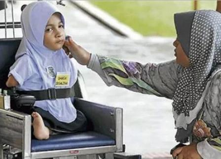 Meski Tanpa Lengan dan Hanya Satu Kaki, Gadis Cilik Ini Bersemangat untuk Sekolah